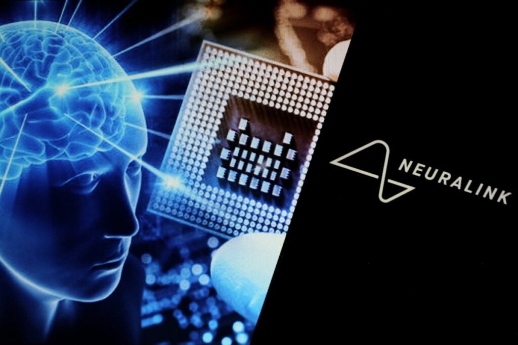 Elon Musk Says 'Clear Path' To Restoring Hearing With Neuralink, But The Deaf Community Want To Have Their 'Say'