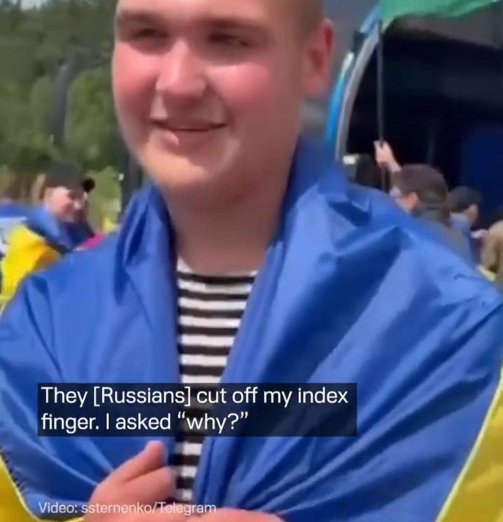 Russian forces cut off the finger of a Ukrainian soldier from Sloviansk while he was in captivity. Today, he returned home.