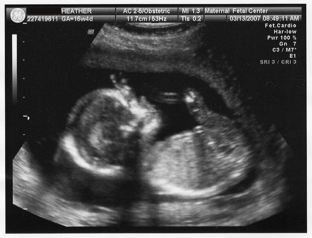 Climate disasters can alter kids’ brains before they’re even born