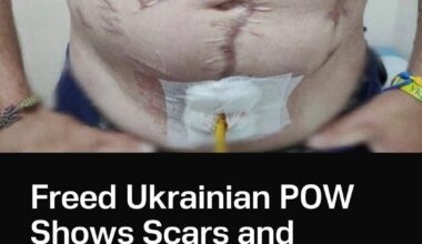 A released Ukrainian soldier revealed signs of brutal tortures. His body is covered with mutilations and a burned-in phrase: “Glory to Russia”