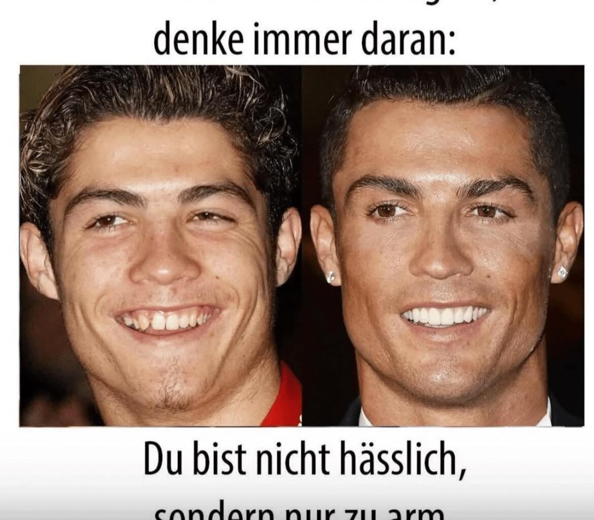 Bestes Beispiel oder 😂