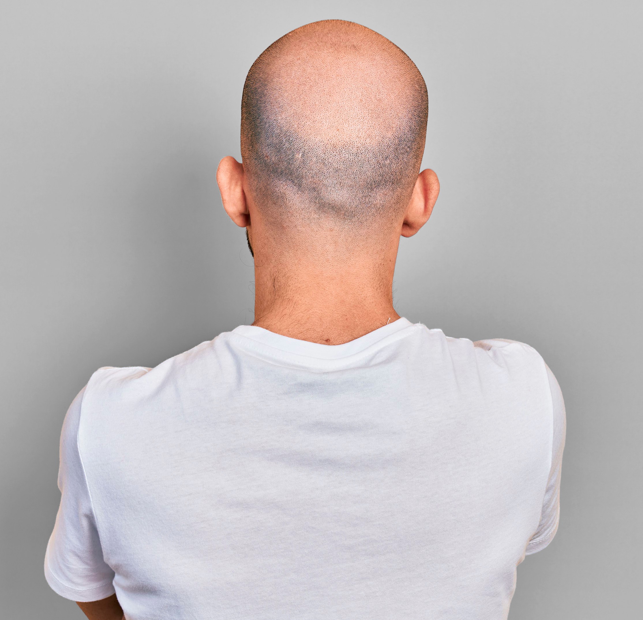 Young,Bald,Man,Wearing,Casual,White,T,Shirt,Standing,Backwards