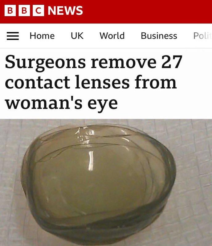 She only see 240p