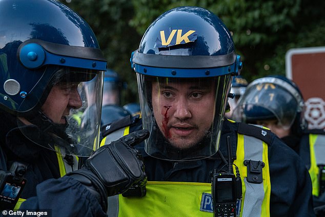 A police officer suffered an injury to the cheek, which caused him to bleed, during the protests against migrants being housed in The Bell Hotel in Epping on July 20