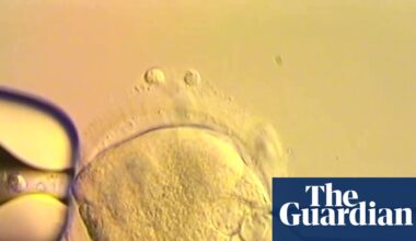 The babies born with DNA from three parents – podcast | IVF