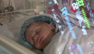 Tampa General Hospital, USF developing artificial intelligence to monitor NICU baby's pain in real-time