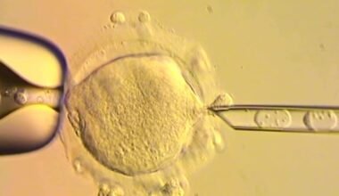 Screen grab taken from handout video of a diagram showing the embryo replacement procedure.