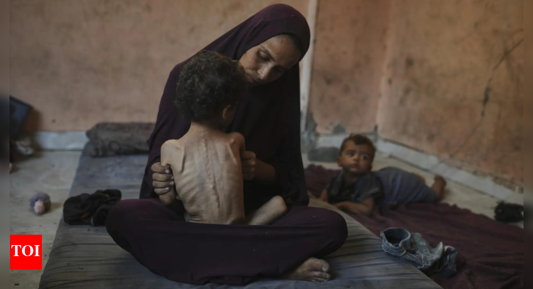 'Walking corpses': Photos of malnourished Gaza toddler go viral as humanitarian situation worsens; see pics inside
