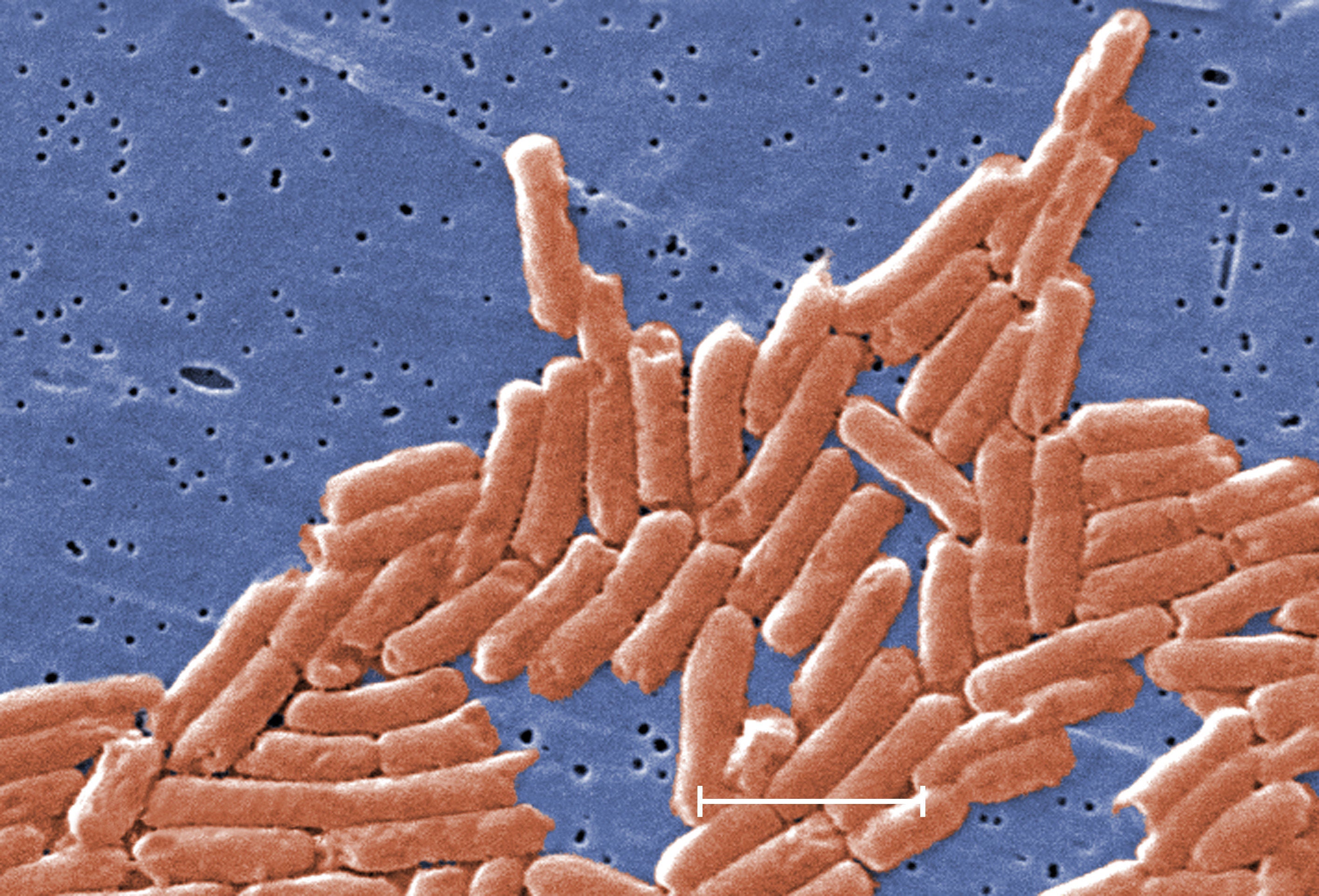 The outbreak caused more than 100 people to get sick and at least 14 to be hospitalised with the diarrhoea-causing bug in 2024 (Centre for Disease Control and Prevention/PA)