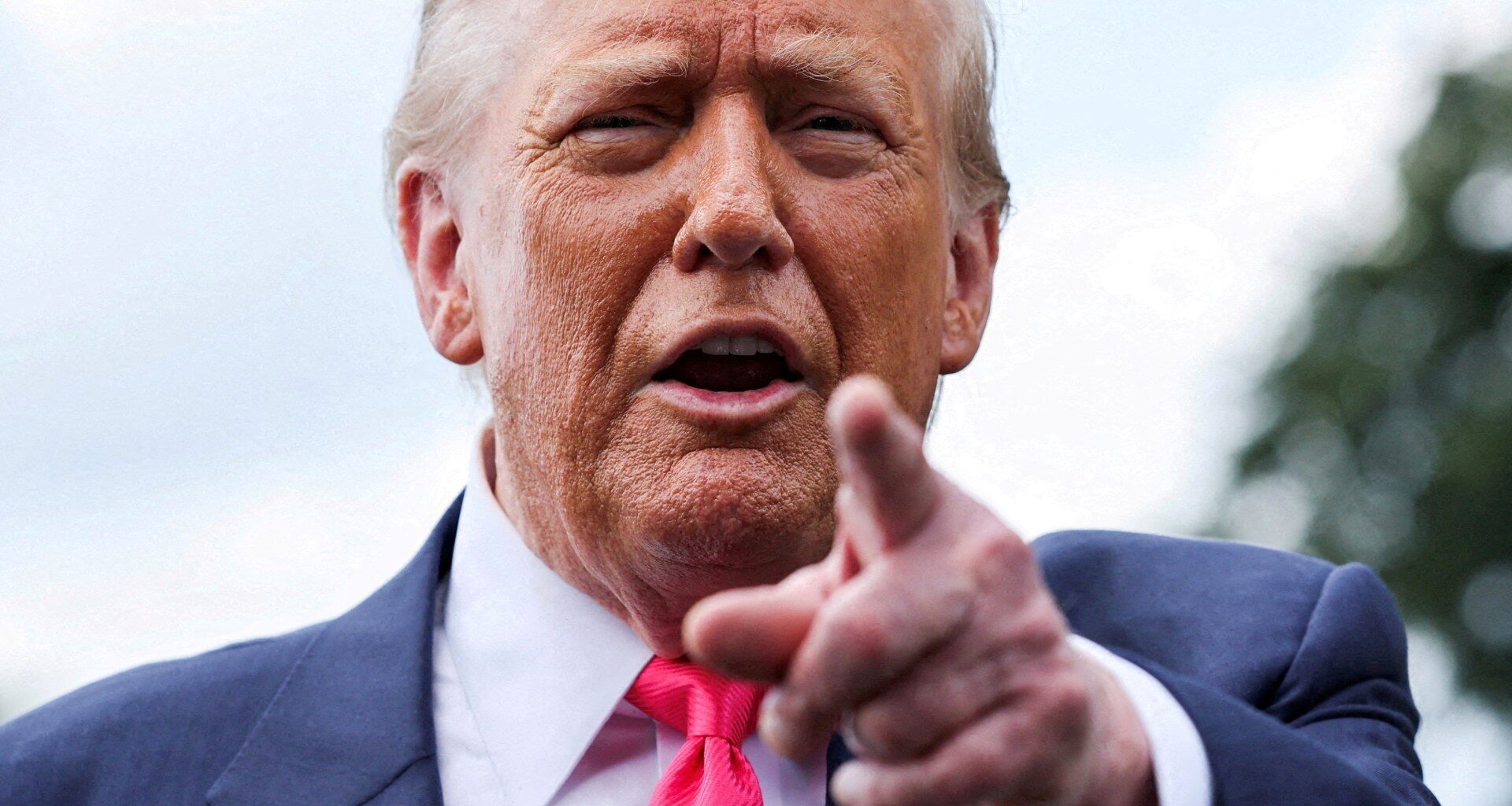 What is chronic venous insufficiency; how serious is Trump’s condition? | Donald Trump News