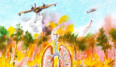 A nation mobilized: Türkiye’s relentless battle against forest fires