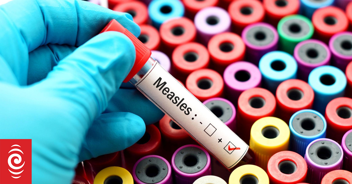Fourth case of measles confirmed in Wairarapa