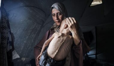 Guerre Israël-Gaza : le chef de l’OMS affirme qu’une "grande proportion" des gens à Gaza meurt de faim