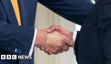 What is Trump's vein condition and how serious is it?
