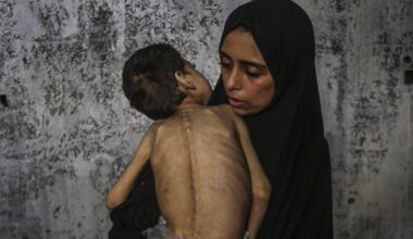 Israel Under Increased Global Pressure To End Starvation In Gaza: Live Updates