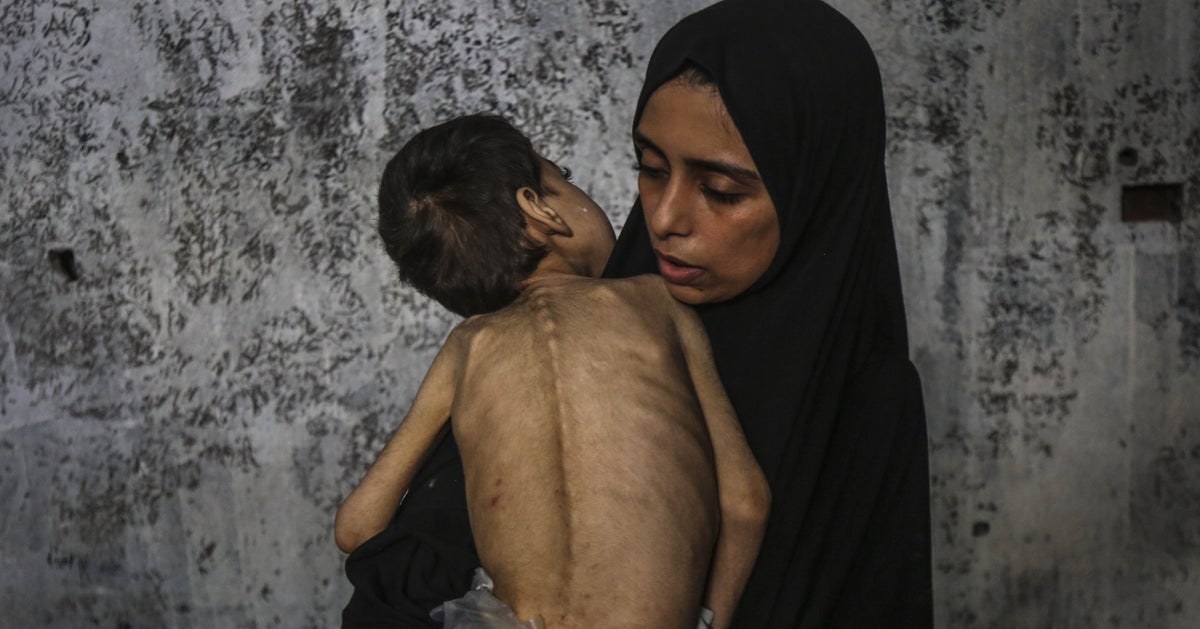 Israel Under Increased Global Pressure To End Starvation In Gaza: Live Updates
