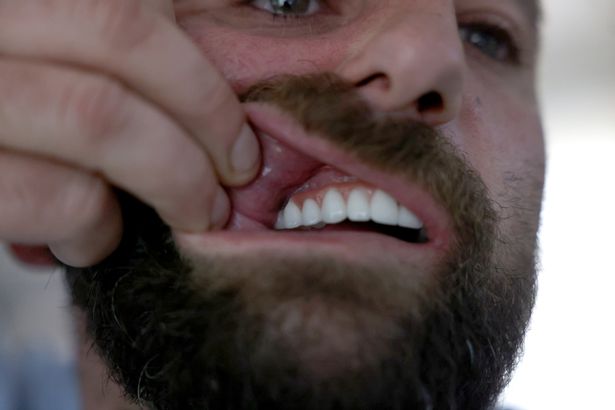 Matthew Bowen is unhappy with his new teeth
