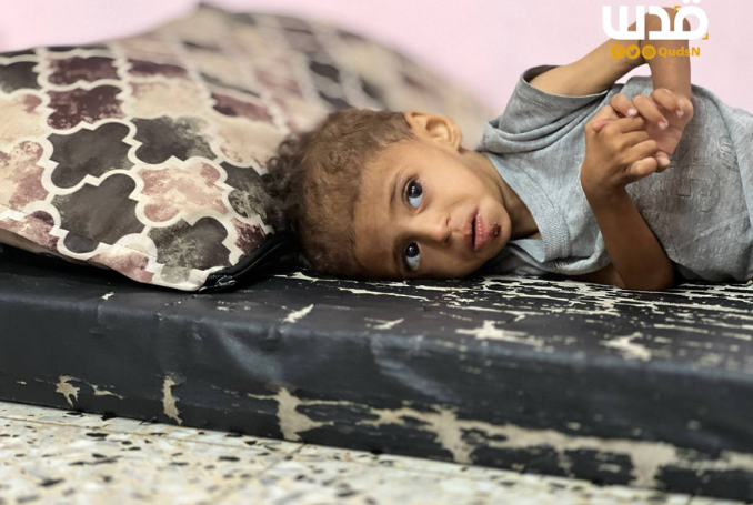 LIVE BLOG: Israel Slaughters Scores of Aid Seekers as Witkoff Plans Tel Aviv Visit - Day 663
