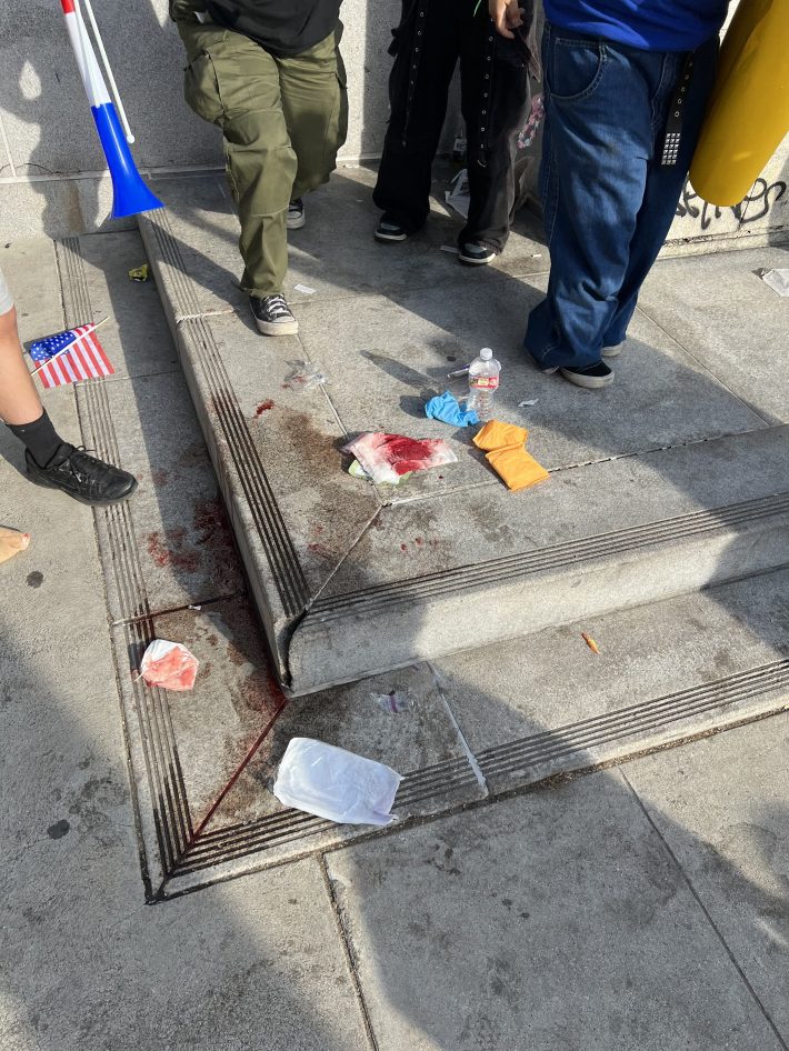 Blood soaked gauze on the steps of City Hall.