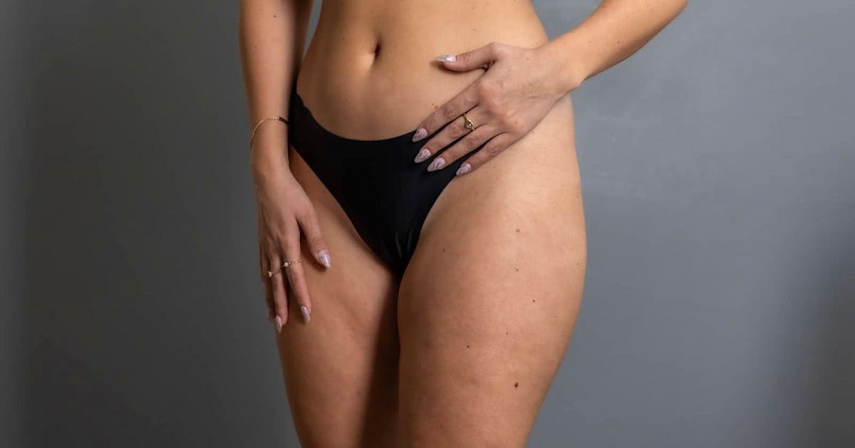 Eine Nymphoplastie ist oftmals ein Eingriff ohne medizinische Notwendigkeit.