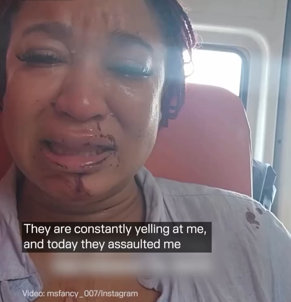 LeopardAteMyFace, Russian Edition: fled U.S. “racism” for “safety” in Russia — got beaten by racist neighbors