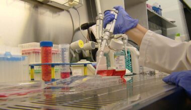 Stem cell therapy developed in Poland could revolutionize osteoarthritis treatment