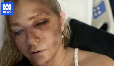 Virginia Giuffre, Epstein and Prince Andrew accuser, treated in Perth hospital