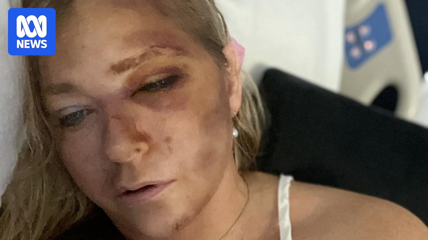 Virginia Giuffre, Epstein and Prince Andrew accuser, treated in Perth hospital