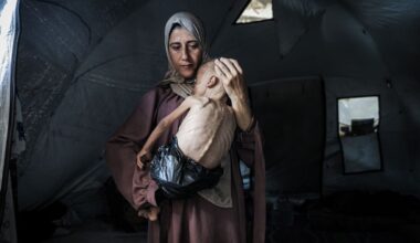 Photos: Starvation in Gaza