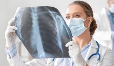 Tuberkulose-Ausbruch in Deutschland: Besteht Gefahr für Menschen?