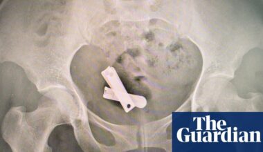 Rusted screws, metal spikes and plastic rubbish: the horrific sexual violence used against Tigray’s women - The Guardian