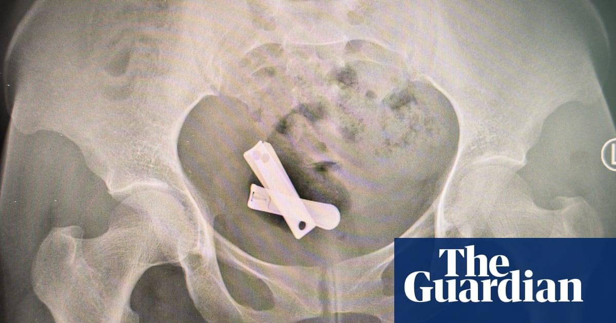 Rusted screws, metal spikes and plastic rubbish: the horrific sexual violence used against Tigray’s women - The Guardian