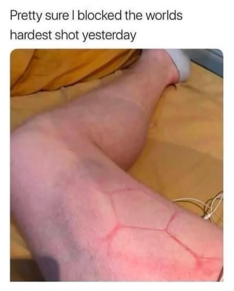 "Let's not kick strong”