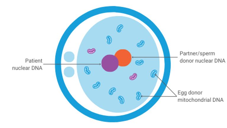 A diagram showing an embryo o created by mitochondrial donation. Pic: PA 