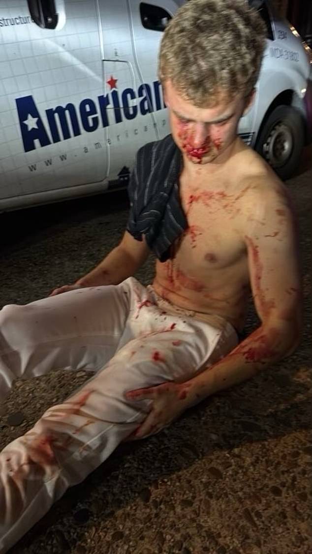 St. Clair also took aim at Musk's one-time protégé Edward 'Big Balls' Coristine, 19, who was violently attacked while trying to stop a carjacking on August 3