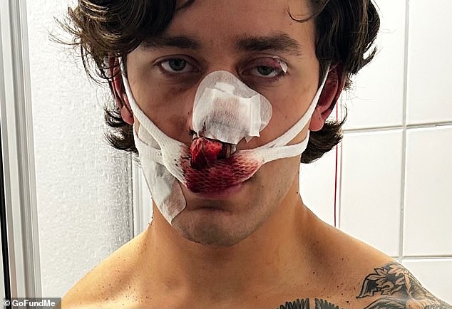 John Rudat (pictured), 21, was left bloodied and battered after trying to stop two women from being violently assaulted on German public transit