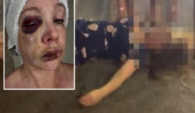 Russian woman beaten in Cincinnati brawl returns home, attacker's family claims race driving outrage