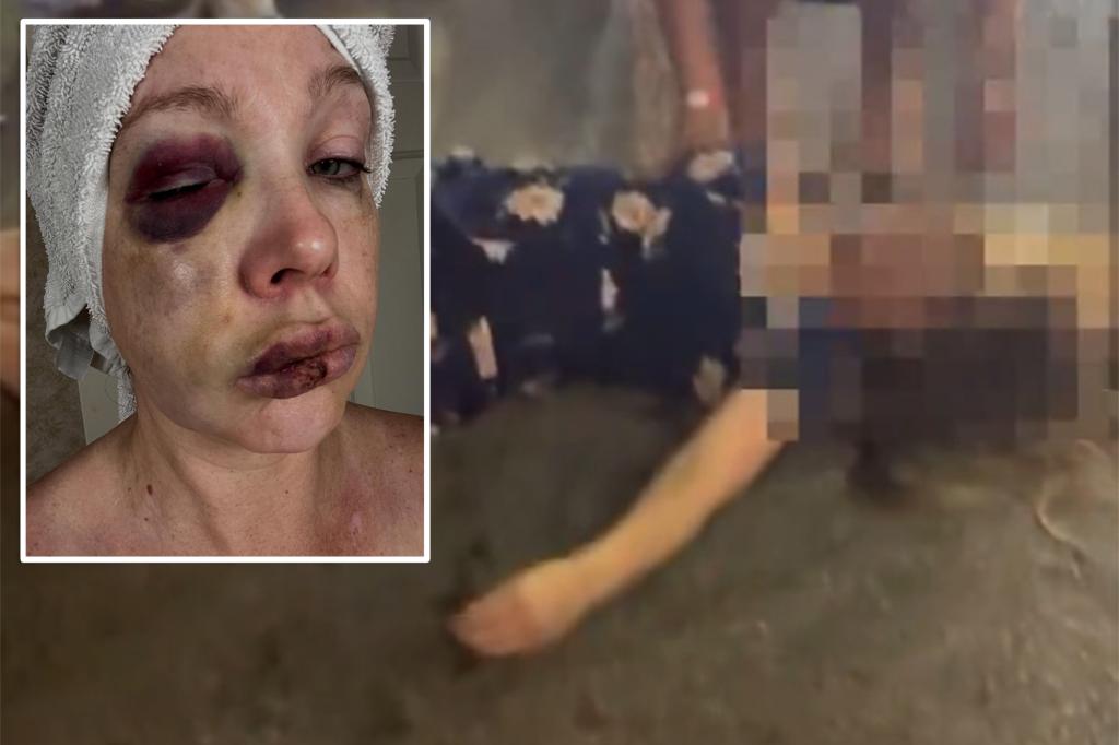 Russian woman beaten in Cincinnati brawl returns home, attacker's family claims race driving outrage