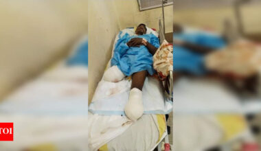Migrant worker seeks help after losing legs in Bengaluru | Bhubaneswar News