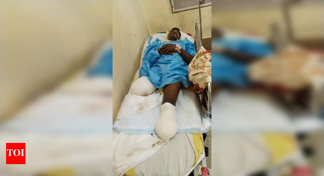 Migrant worker seeks help after losing legs in Bengaluru | Bhubaneswar News