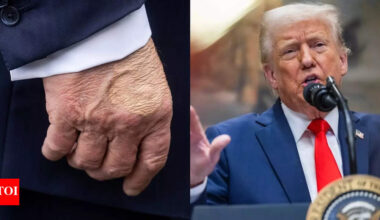 What’s going on with Donald Trump’s hands? Viral photos show large blotches of 'foundation' on POTUS' hands |