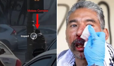 New video shows man injured by less-lethal projectile fired by officer during downtown Los Angeles immigration raid protest