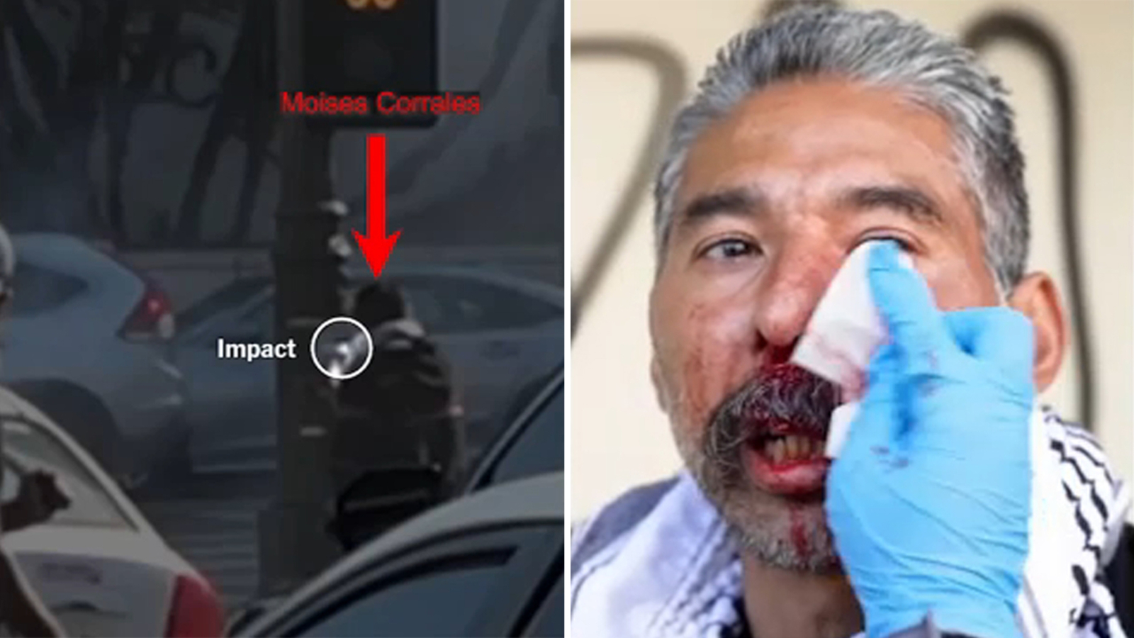 New video shows man injured by less-lethal projectile fired by officer during downtown Los Angeles immigration raid protest