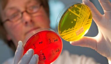 Sorge um tödliches Bakterium – „Dringend alle Fragen klären“