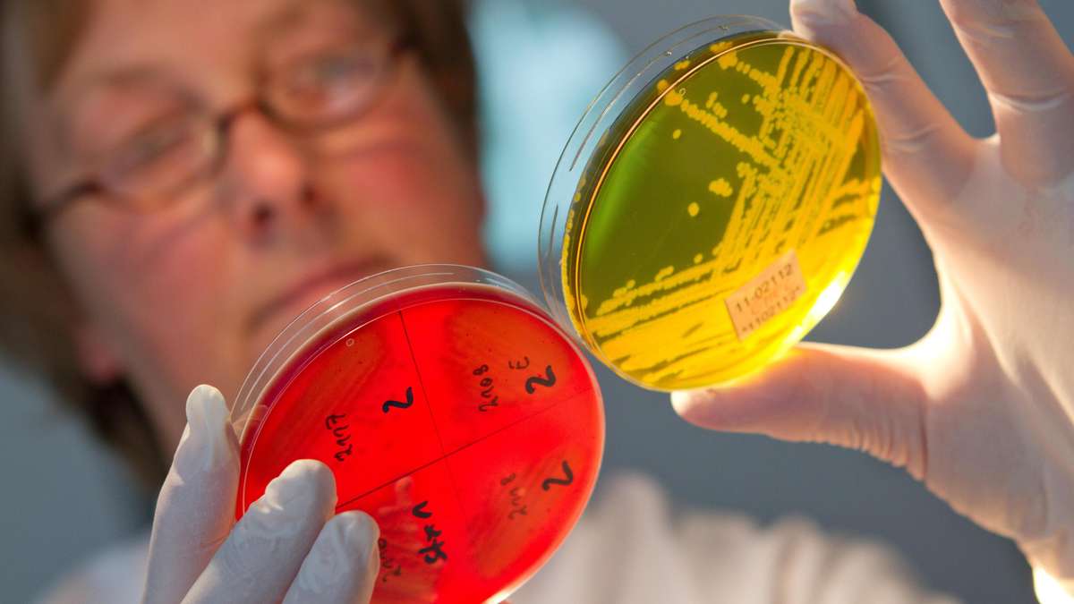 Sorge um tödliches Bakterium – „Dringend alle Fragen klären“