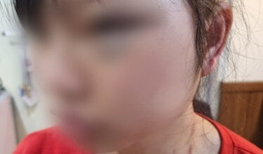 The female migrant worker that was assaulted by a man in his 40s while working at a company in Yongin, Gyeonggi [YONHAP]