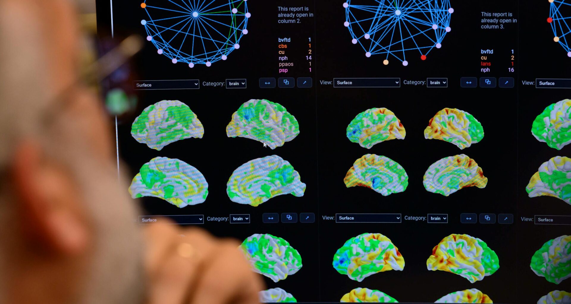 At Mayo, artificial intelligence is the next major technological frontier in medicine