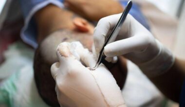 Brit dies in Turkey after hair transplant as 'homicide investigation launched'