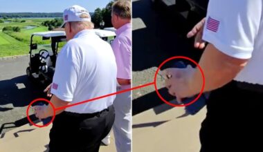 Trump, 79, Spotted With New Bruise on His Other Hand