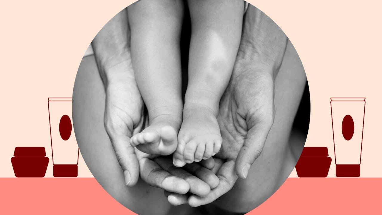 Treårig gik i puberteten efter kontakt med sin mors hormoner - Hormonbehandling på huden kan smitte af på andre og påvirke hormonsystemet hos børn, voksne og kæledyr.